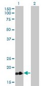 Monoclonal Anti-TNNC1 antibody produced in mouse clone 1F8-A9, purified immunoglobulin, buffered aqueous solution