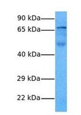 Anti-MMP9 antibody produced in rabbit IgG fraction of antiserum