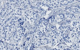 Anti-GATA-3 Antibody, clone 1B11 ZooMAb® Rabbit Monoclonal recombinant, expressed in HEK 293 cells