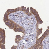 Anti-BECN1 antibody produced in rabbit Prestige Antibodies® Powered by Atlas Antibodies, affinity isolated antibody, buffered aqueous glycerol solution