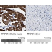 Anti-MYBPC1 antibody produced in rabbit Prestige Antibodies® Powered by Atlas Antibodies, affinity isolated antibody, buffered aqueous glycerol solution