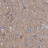 Anti-ASCC3 antibody produced in rabbit Prestige Antibodies® Powered by Atlas Antibodies, affinity isolated antibody, buffered aqueous glycerol solution, ab3