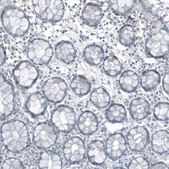 Monoclonal Anti-FRMD5 antibody produced in mouse Prestige Antibodies® Powered by Atlas Antibodies, clone CL9503, purified immunoglobulin, buffered aqueous glycerol solution