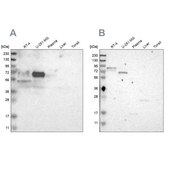 Anti-FRMD5 antibody produced in rabbit Ab1, Prestige Antibodies® Powered by Atlas Antibodies, affinity isolated antibody, buffered aqueous glycerol solution