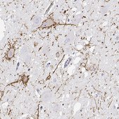 Anti-CALCR antibody produced in rabbit Prestige Antibodies® Powered by Atlas Antibodies, affinity isolated antibody, buffered aqueous glycerol solution