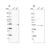 Anti-UQCRC1 antibody produced in rabbit Ab1, Prestige Antibodies® Powered by Atlas Antibodies, affinity isolated antibody, buffered aqueous glycerol solution