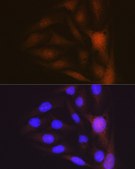 Anti-Musashi-1 (MSI1) Antibody, clone 9S7Y1, Rabbit Monoclonal
