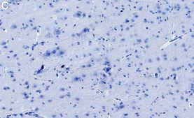 Anti-CACNG8/TARP γ8 Antibody, clone 1K4 ZooMAb® Rabbit Monoclonal recombinant, expressed in HEK 293 cells