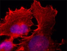 抗-E6AP小鼠单克隆抗体 clone E6AP-330, purified from hybridoma cell culture