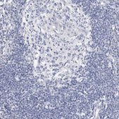 Anti-SLC22A12 antibody produced in rabbit Prestige Antibodies® Powered by Atlas Antibodies, affinity isolated antibody, buffered aqueous glycerol solution