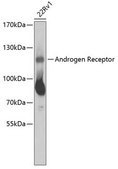 Anti-Androgen receptor antibody produced in rabbit