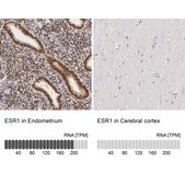 Anti-ESR1 antibody produced in rabbit Ab2, Prestige Antibodies® Powered by Atlas Antibodies, affinity isolated antibody, buffered aqueous glycerol solution