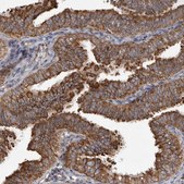Anti-CDK5RAP3 antibody produced in rabbit Prestige Antibodies® Powered by Atlas Antibodies, affinity isolated antibody, buffered aqueous glycerol solution