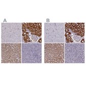 Anti-PAH antibody produced in rabbit Prestige Antibodies® Powered by Atlas Antibodies, affinity isolated antibody, buffered aqueous glycerol solution