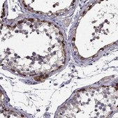 Anti-SCNN1D antibody produced in rabbit Prestige Antibodies® Powered by Atlas Antibodies, affinity isolated antibody, buffered aqueous glycerol solution