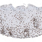 Monoclonal Anti-SETD2 antibody produced in mouse Prestige Antibodies® Powered by Atlas Antibodies, clone CL9956, purified immunoglobulin, buffered aqueous glycerol solution