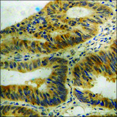 Anti-phospho-eIF2 α (pSer51) antibody produced in rabbit affinity isolated antibody
