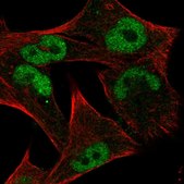 Anti-MYC antibody produced in rabbit Prestige Antibodies® Powered by Atlas Antibodies, affinity isolated antibody