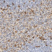 抗-IL18 兔抗 Prestige Antibodies® Powered by Atlas Antibodies, affinity isolated antibody, buffered aqueous glycerol solution