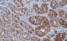 Anti-Cathepsin B Antibody, clone 1G7 ZooMAb® Rabbit Monoclonal recombinant, expressed in HEK 293 cells