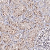 Anti-SH3BP5 antibody produced in rabbit Prestige Antibodies® Powered by Atlas Antibodies, affinity isolated antibody, buffered aqueous glycerol solution