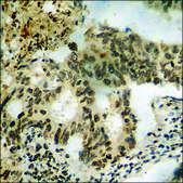 Anti-phospho-RAD51 (pTyr315) antibody produced in rabbit affinity isolated antibody