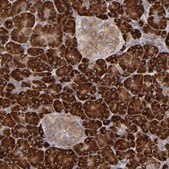 Anti-MTHFD1 antibody produced in rabbit Prestige Antibodies® Powered by Atlas Antibodies, affinity isolated antibody, buffered aqueous glycerol solution