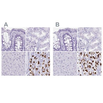 Anti-ATP4B antibody produced in rabbit Prestige Antibodies® Powered by Atlas Antibodies, affinity isolated antibody, buffered aqueous glycerol solution