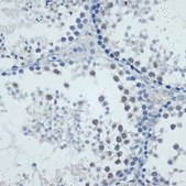 Anti-MMP9 antibody produced in rabbit
