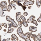 抗-FOXO1 兔抗 Prestige Antibodies® Powered by Atlas Antibodies, affinity isolated antibody, buffered aqueous glycerol solution