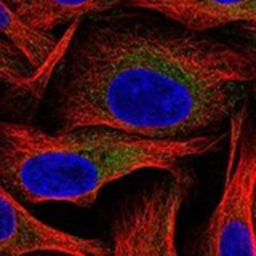 Anti-HK2 antibody produced in rabbit Prestige Antibodies® Powered by Atlas Antibodies, affinity isolated antibody, buffered aqueous glycerol solution