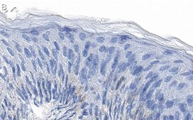 Anti-GRHL2 Antibody, clone 2N18 ZooMAb® Rabbit Monoclonal recombinant, expressed in HEK 293 cells