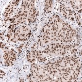 Monoclonal Anti-Smarcb1 Antibody Produced In Mouse Prestige Antibodies® Powered by Atlas Antibodies, clone CL13973, affinity isolated antibody, buffered aqueous glycerol solution