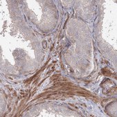 Anti-SH3PXD2A antibody produced in rabbit Prestige Antibodies® Powered by Atlas Antibodies, affinity isolated antibody, buffered aqueous glycerol solution