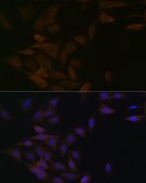 Anti-PP2A alpha + beta antibody produced in rabbit