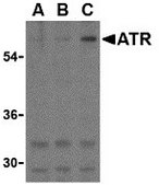 Anti-ATR antibody produced in rabbit purified antibody (Ion exchange)