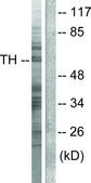 Anti-Tyrosine Hydroxylase, N-Terminal antibody produced in rabbit affinity isolated antibody