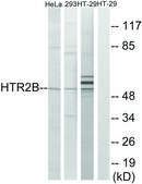 Anti-HTR2B antibody produced in rabbit affinity isolated antibody