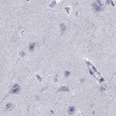 Anti-SERPINA3 antibody produced in rabbit Prestige Antibodies® Powered by Atlas Antibodies, affinity isolated antibody, buffered aqueous glycerol solution