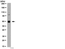 Anti-Tyrosine Hydroxylase Antibody from rabbit