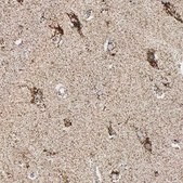 ANTI-HSPA9 antibody produced in rabbit Prestige Antibodies® Powered by Atlas Antibodies, affinity isolated antibody, buffered aqueous glycerol solution