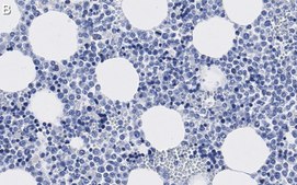 Anti-CD63 Antibody, clone 3H6 ZooMAb® Rabbit Monoclonal recombinant, expressed in HEK 293 cells