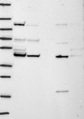 Anti-TIMM44 antibody produced in rabbit Prestige Antibodies® Powered by Atlas Antibodies, affinity isolated antibody, buffered aqueous glycerol solution