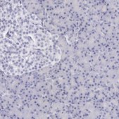 Anti-EGFR antibody produced in rabbit Ab1, Prestige Antibodies® Powered by Atlas Antibodies, affinity isolated antibody, buffered aqueous glycerol solution
