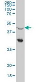 Monoclonal Anti-NR0B1, (C-terminal) antibody produced in mouse clone 1F10, purified immunoglobulin, buffered aqueous solution