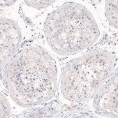 Monoclonal Anti-NANOG antibody produced in mouse Prestige Antibodies® Powered by Atlas Antibodies, clone CL5803, purified immunoglobulin, buffered aqueous glycerol solution
