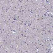 Anti-NPY antibody produced in rabbit Prestige Antibodies® Powered by Atlas Antibodies, affinity isolated antibody, buffered aqueous glycerol solution