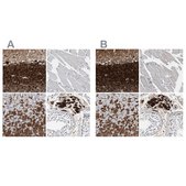 Anti-CALB2 antibody produced in rabbit Prestige Antibodies® Powered by Atlas Antibodies, affinity isolated antibody, buffered aqueous glycerol solution