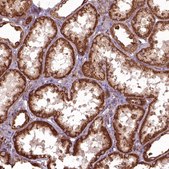 Anti-HYAL1 antibody produced in rabbit Prestige Antibodies® Powered by Atlas Antibodies, affinity isolated antibody, buffered aqueous glycerol solution