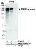 Rabbit anti-RNA Polymerase II Antibody, Affinity Purified Powered by Bethyl Laboratories, Inc.